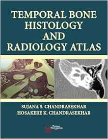 Temporal Bone Histology and Radiology Atlas (EPUB)