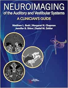 Neuroimaging of the Auditory and Vestibular Systems: A Clinician's Guide (EPUB)