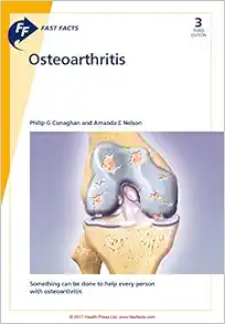 Fast Facts: Osteoarthritis, 3rd Edition (Original PDF from Publisher)