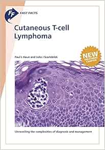 Cutaneous T-cell Lymphoma (Fast Facts) (EPUB)