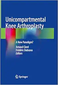 Unicompartmental Knee Arthroplasty: A New Paradigm? (EPUB)