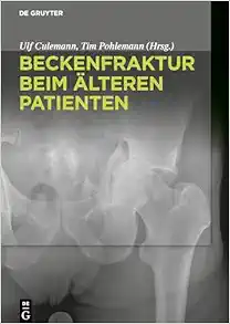 Beckenfraktur beim älteren Patienten (German Edition) (Original PDF from Publisher)