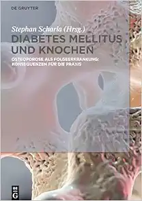 Diabetes Mellitus und Knochen: Osteoporose als Folgeerkrankung: Konsequenzen für die Praxis (German Edition) (Original PDF from Publisher)