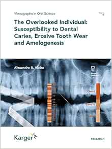 The Overlooked Individual: Susceptibility to Dental Caries, Erosive Tooth Wear and Amelogenesis (Monographs In Oral Science, 30) (EPUB)