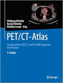 PET/CT-Atlas: Interdisziplinäre PET/CT- und PET/MR-Diagnostik und Therapie, 4th Edition (Original PDF from Publisher)