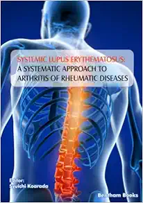 Systemic Lupus Erythematosus: A Systematic Approach to Arthritis of Rheumatic Diseases (Original PDF from Publisher)