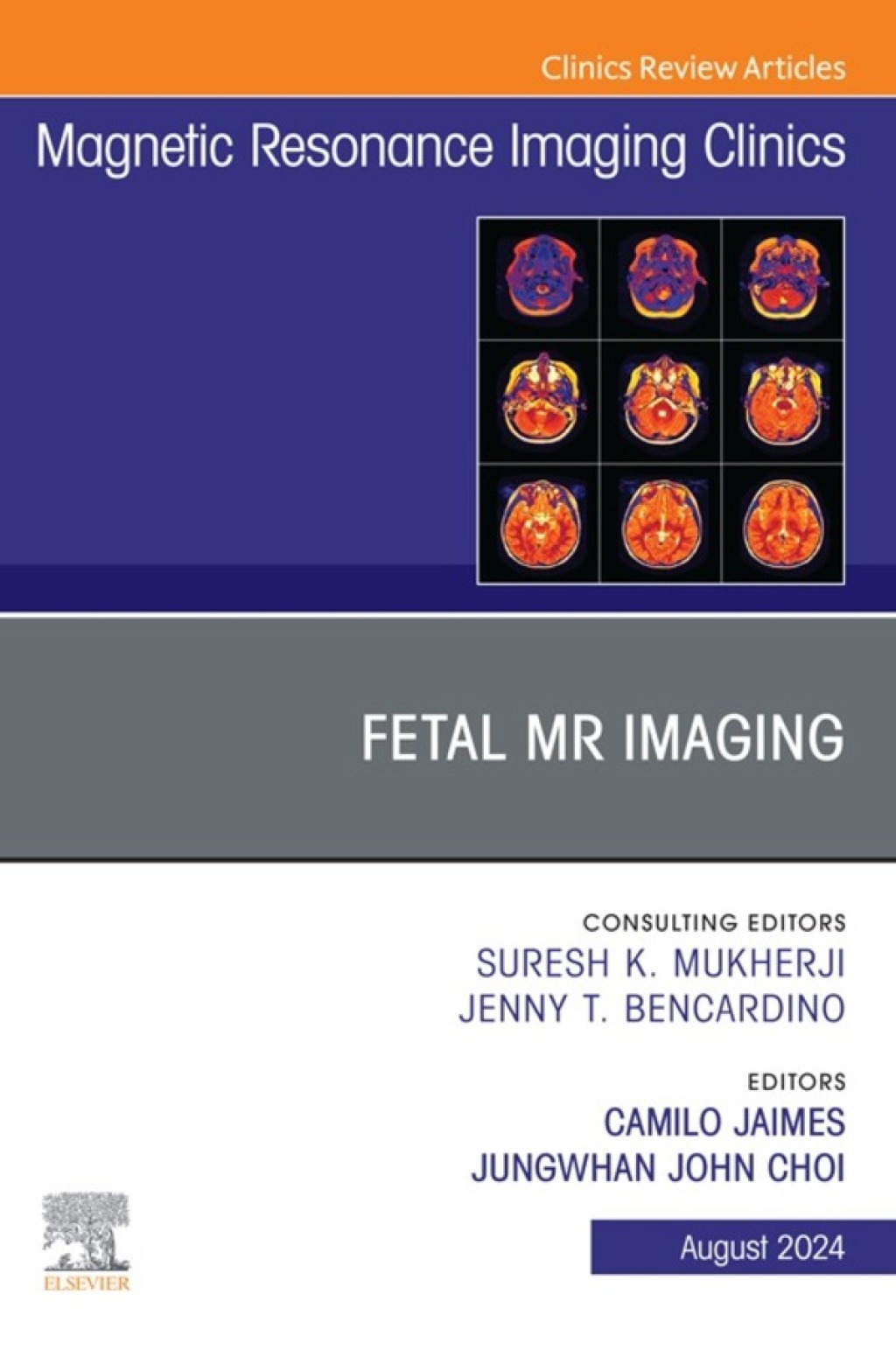 Fetal MRI, An Issue of Magnetic Resonance Imaging Clinics of North America (True PDF from Publisher)