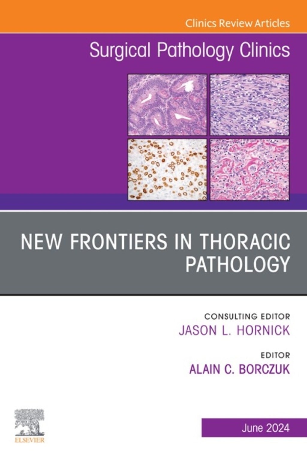 New Frontiers in Thoracic Pathology, An Issue of Surgical Pathology Clinics (True PDF from Publisher)