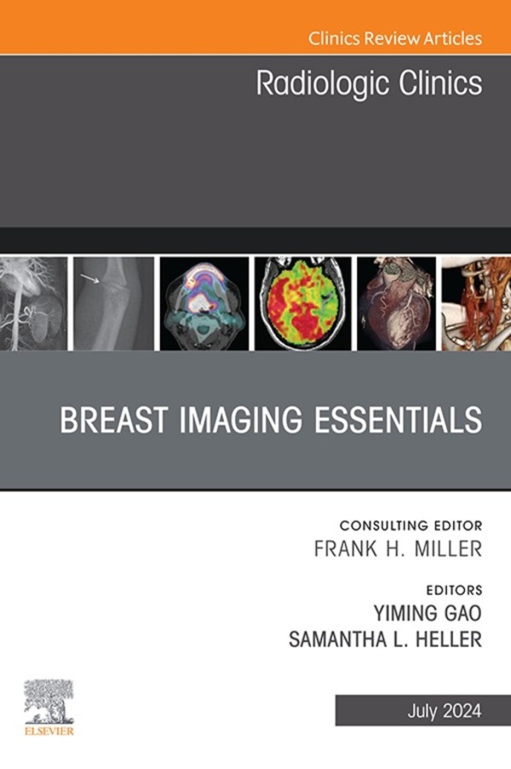 Breast Imaging Essentials, An Issue of Radiologic Clinics of North America (True PDF from Publisher)