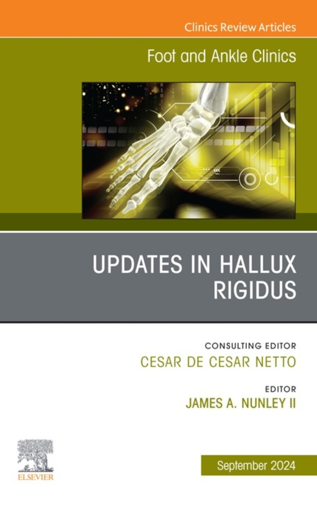 Updates in Hallux Rigidus, An issue of Foot and Ankle Clinics of North America (True PDF from Publisher)