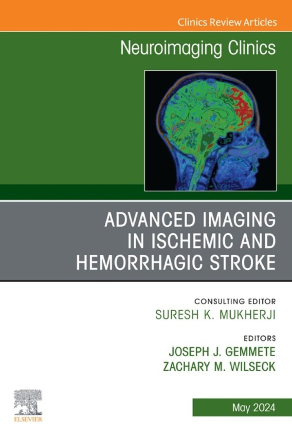 Advanced Imaging in Ischemic and Hemorrhagic Stroke, An Issue of Neuroimaging Clinics of North America (True PDF from Publisher)