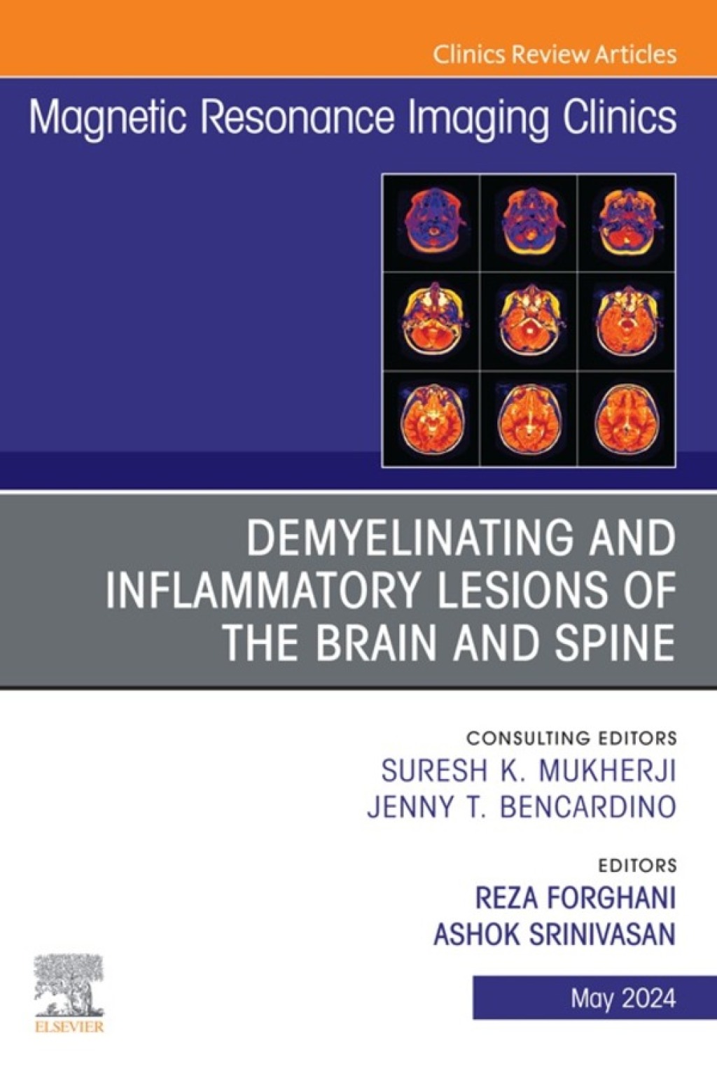 Demyelinating and Inflammatory Lesions of the Brain and Spine, An Issue of Magnetic Resonance Imaging Clinics of North America (True PDF from Publisher)