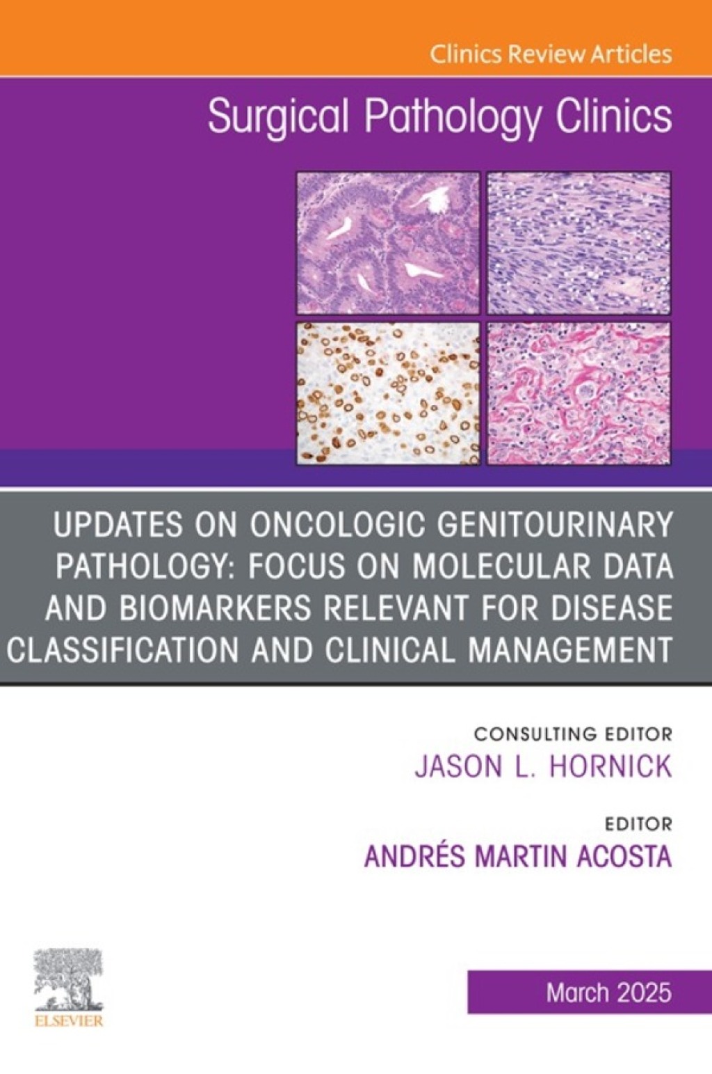 Updates on Oncologic Genitourinary Pathology: Focus on molecular data and biomarkers relevant for disease classification and clinical management, An Issue of Surgical Pathology Clinics (True PDF from Publisher)