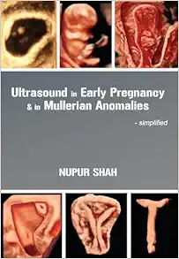 Ultrasound in Early Pregnancy & in Mullerian Anomalies - Simplified (EPUB)