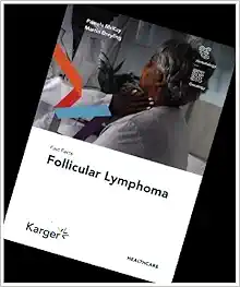 Fast Facts: Follicular Lymphoma (EPUB)