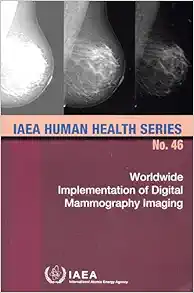 Worldwide Implementation of Digital Mammography Imaging (EPUB)