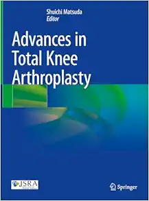Advances in Total Knee Arthroplasty (EPUB)
