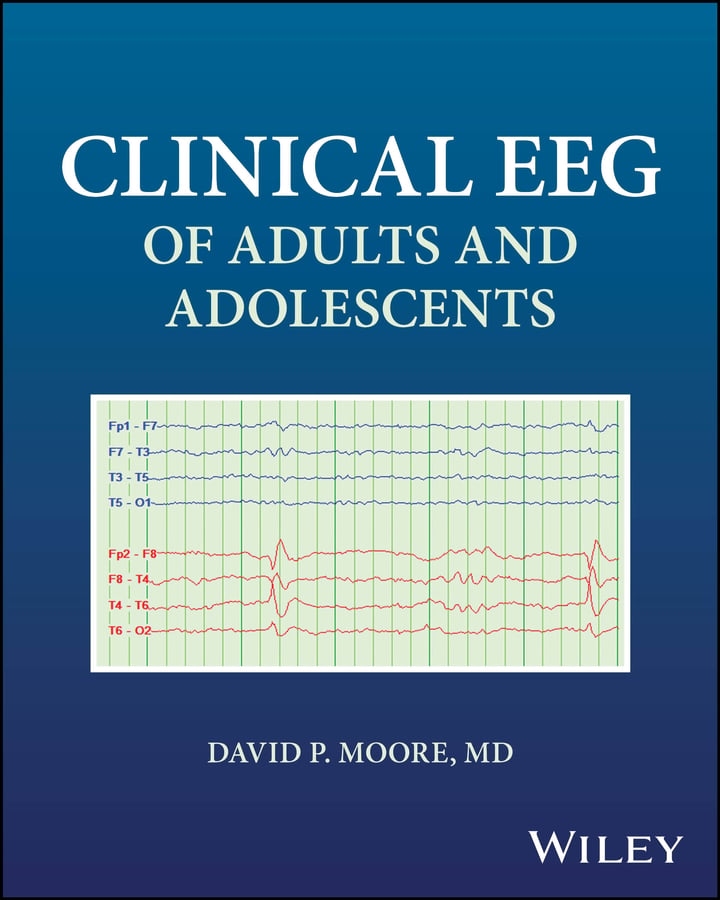 Clinical EEG of Adults and Adolescents (EPUB)