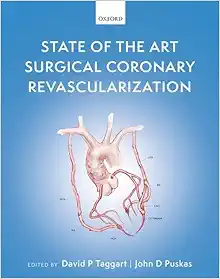 State of the Art Surgical Coronary Revascularization (EPUB)