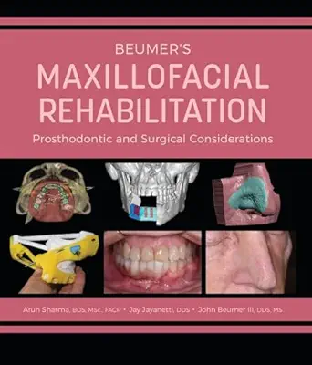 Beumer's Maxillofacial Rehabilitation: Prosthodontics and Surgical Considerations (AZW3 + EPUB)