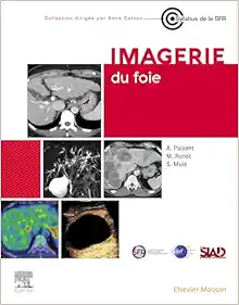 Imagerie du foie (Original PDF from Publisher)