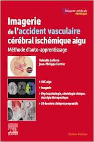 Imagerie de l'accident vasculaire cérébral ischémique aigu: Méthode d'auto-apprentissage (EPUB)