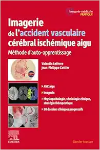 Imagerie de l'accident vasculaire cérébral ischémique aigu: Méthode d'auto-apprentissage (Original PDF from Publisher)