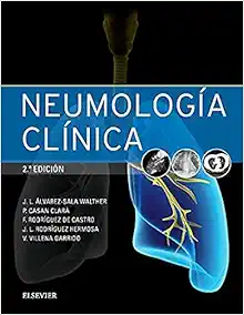 Neumología clínica, 2nd Edition (Original PDF from Publisher)