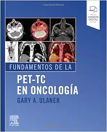Fundamentos de la PET-TC en oncología (Original PDF from Publisher)
