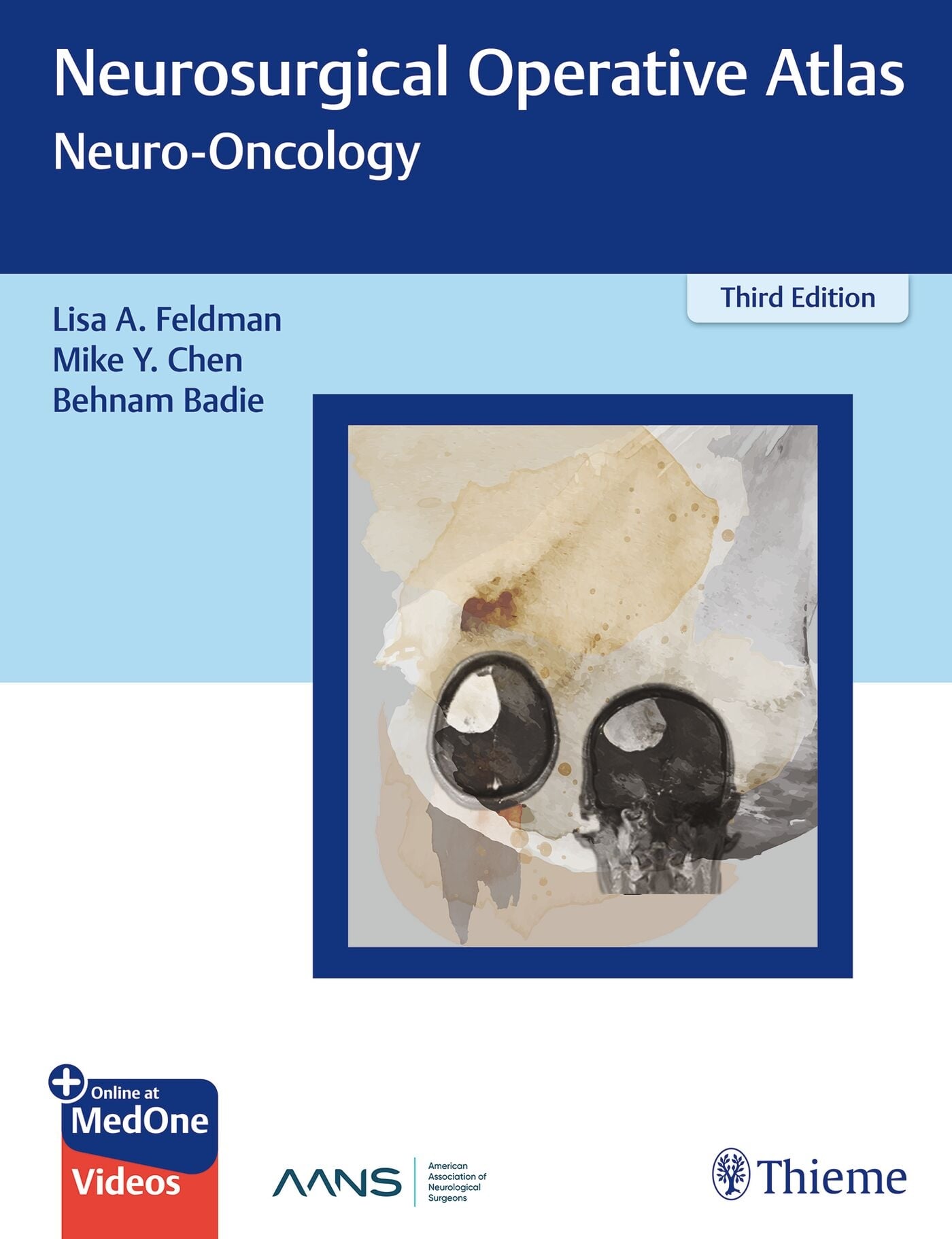 Neurosurgical Operative Atlas: Neuro-Oncology, 3rd edition (True PDF, No Frontmatter)