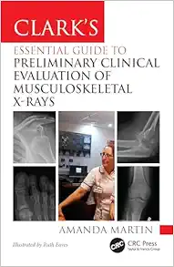 Clark’s Essential Guide to Preliminary Clinical Evaluation of Musculoskeletal X-rays: Evaluating and Commenting on Images (Clark's Companion Essential Guides) (Original PDF from Publisher)