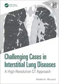 Challenging Cases in Interstitial Lung Diseases (Original PDF from Publisher)