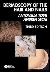 Dermoscopy of the Hair and Nails, 3rd edition (Original PDF from Publisher)