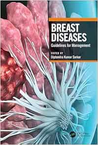 Breast Diseases: Guidelines for Management (Original PDF from Publisher)