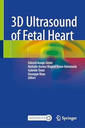 3D Ultrasound of Fetal Heart (EPUB)