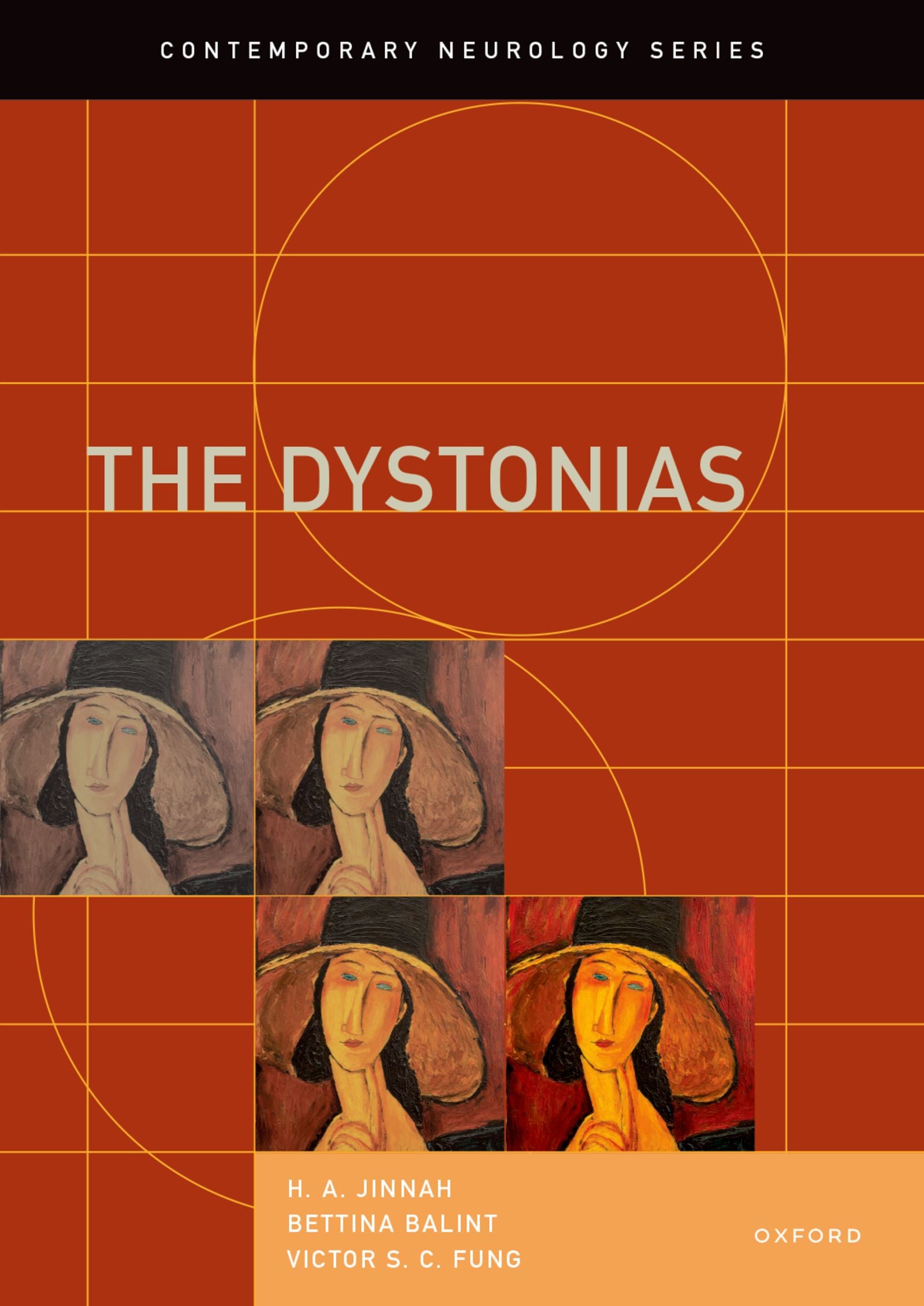 The Dystonias (EPUB)