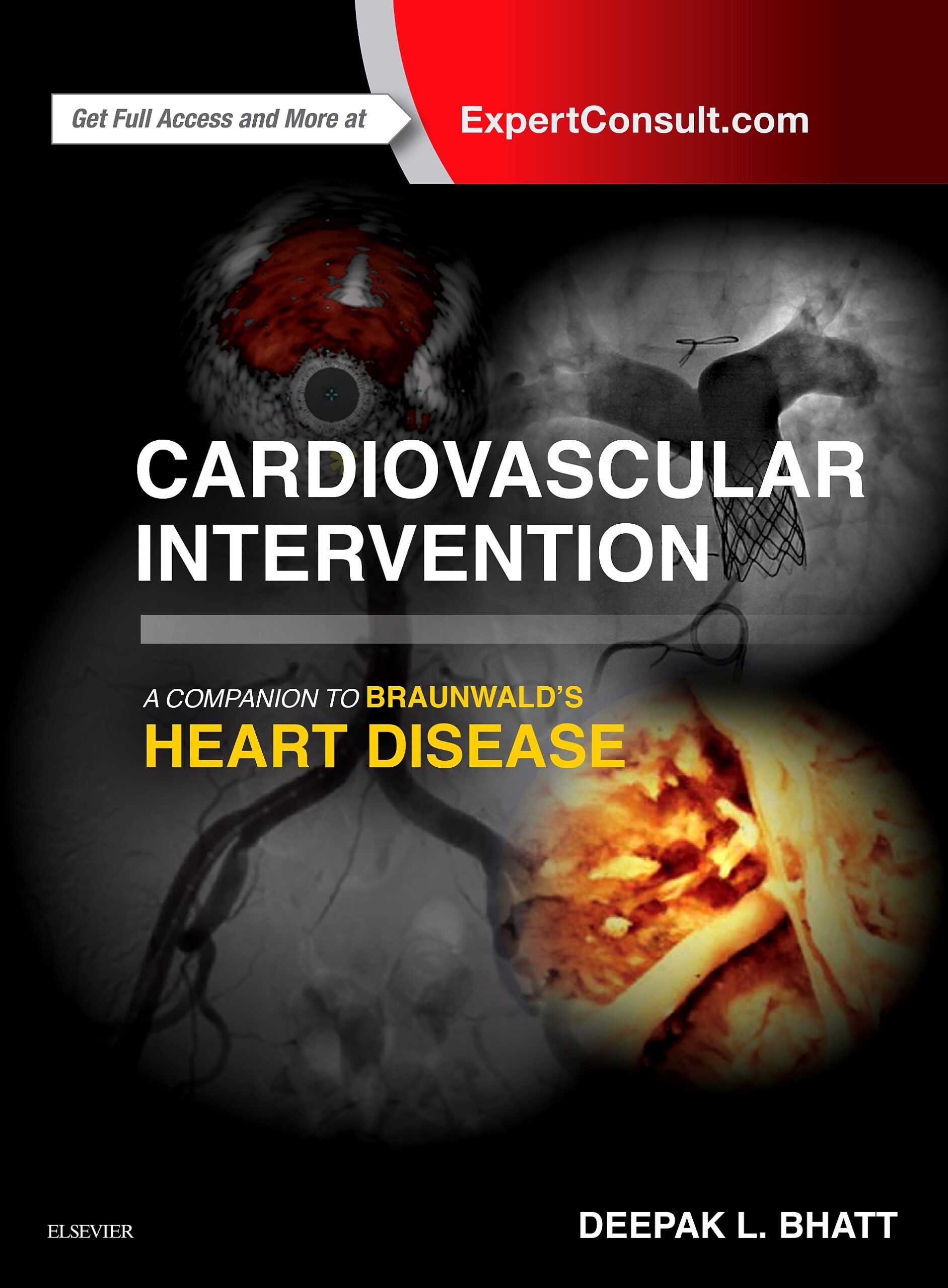 Cardiovascular Intervention: A Companion to Braunwald's Heart Disease (EPUB)