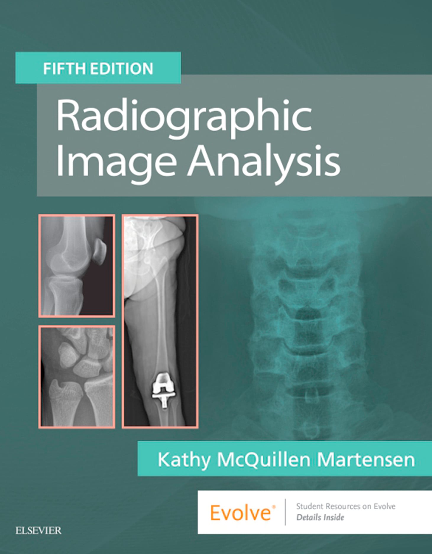 Radiographic Image Analysis, 5th Edition (EPUB)