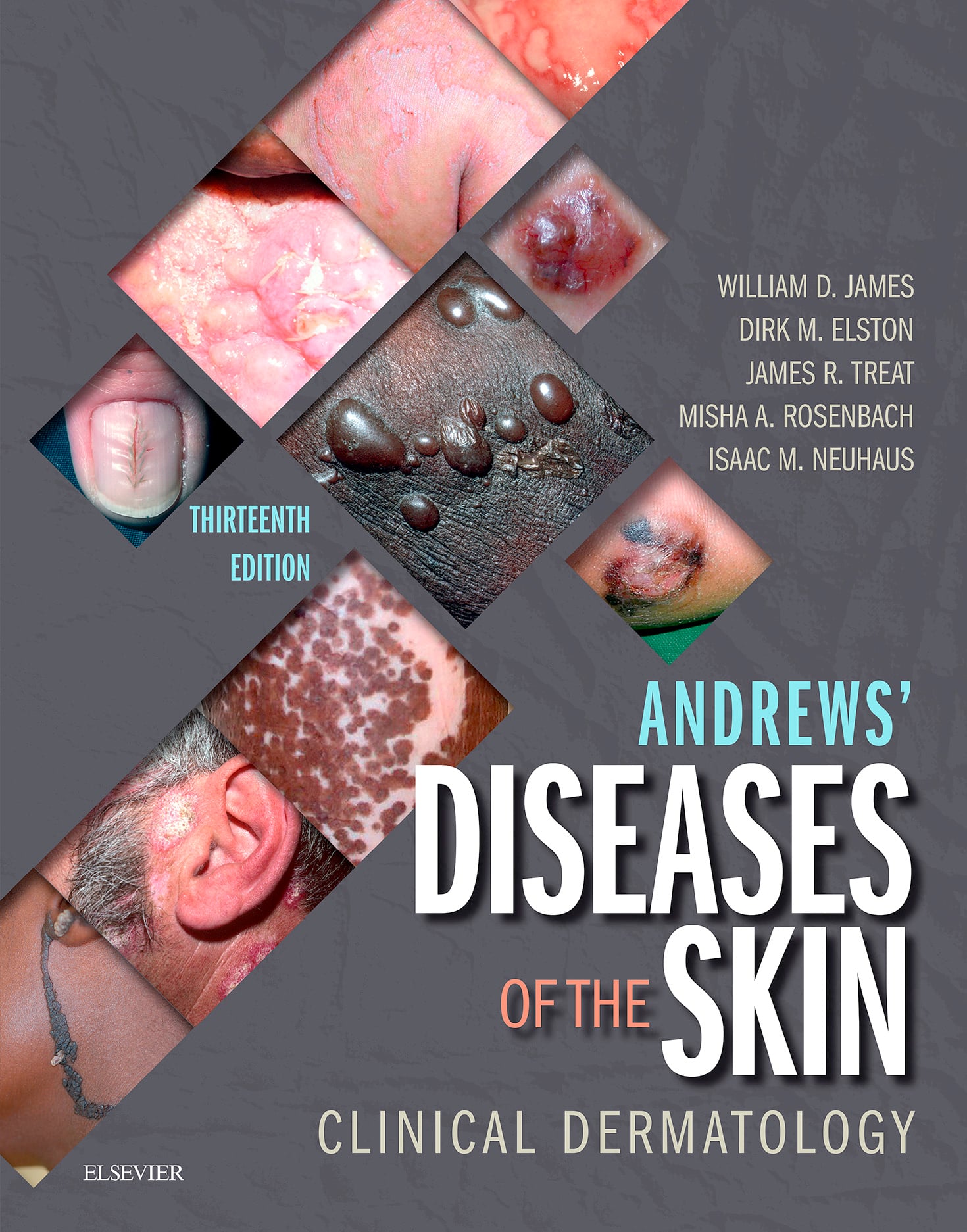 Andrews' Diseases of the Skin: Clinical Dermatology, 13th Edition (EPUB)