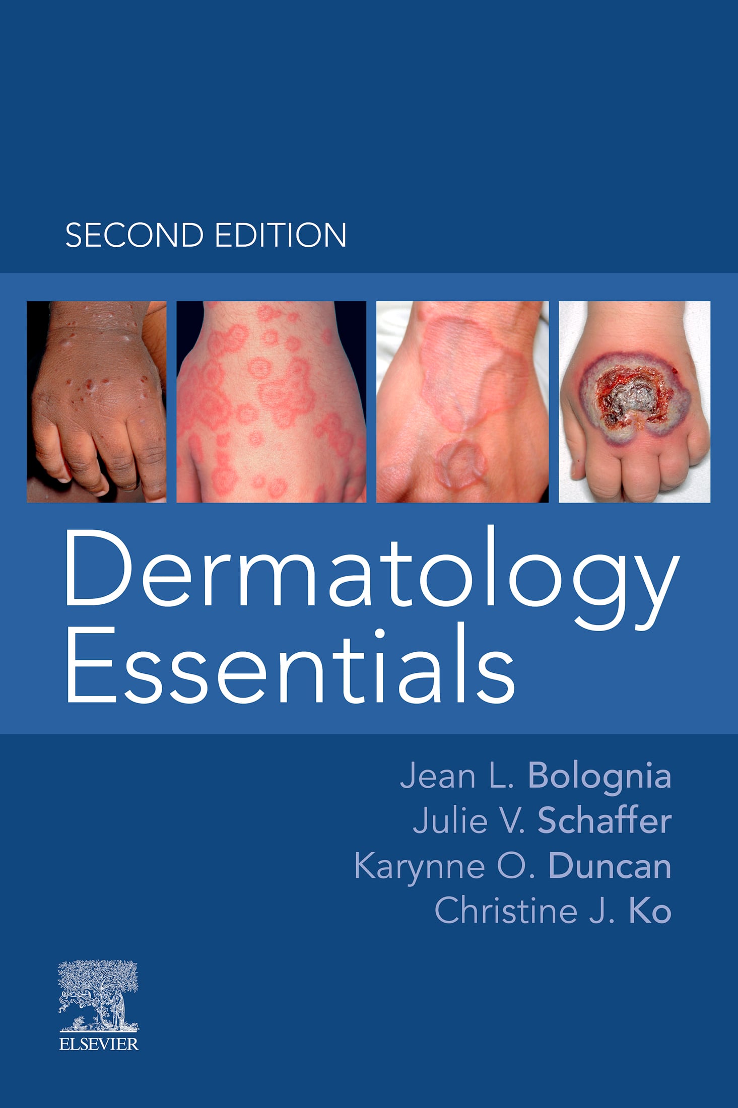 Dermatology Essentials, 2nd Edition (EPUB)