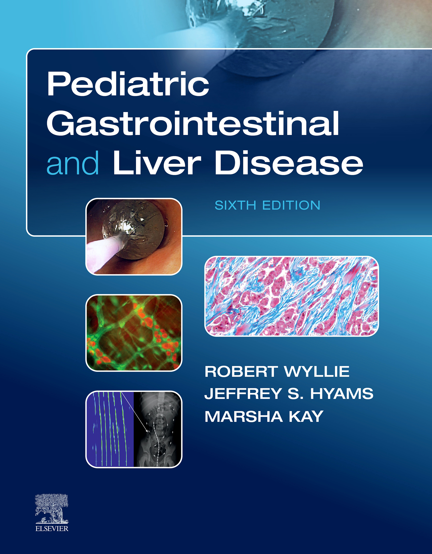 Pediatric Gastrointestinal and Liver Disease, 6th Edition (EPUB)