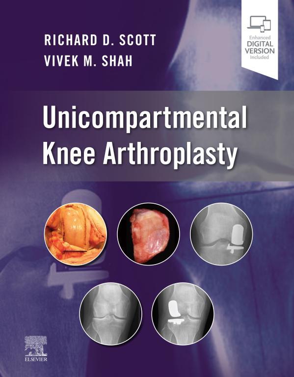 Unicompartmental Knee Arthroplasty (EPUB)