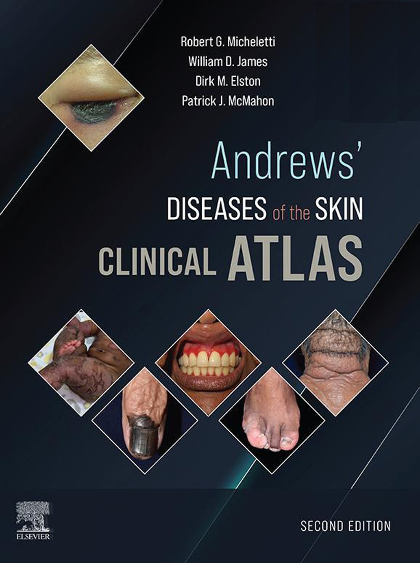 Andrews' Diseases of the Skin Clinical Atlas, 2nd Edition (EPUB)