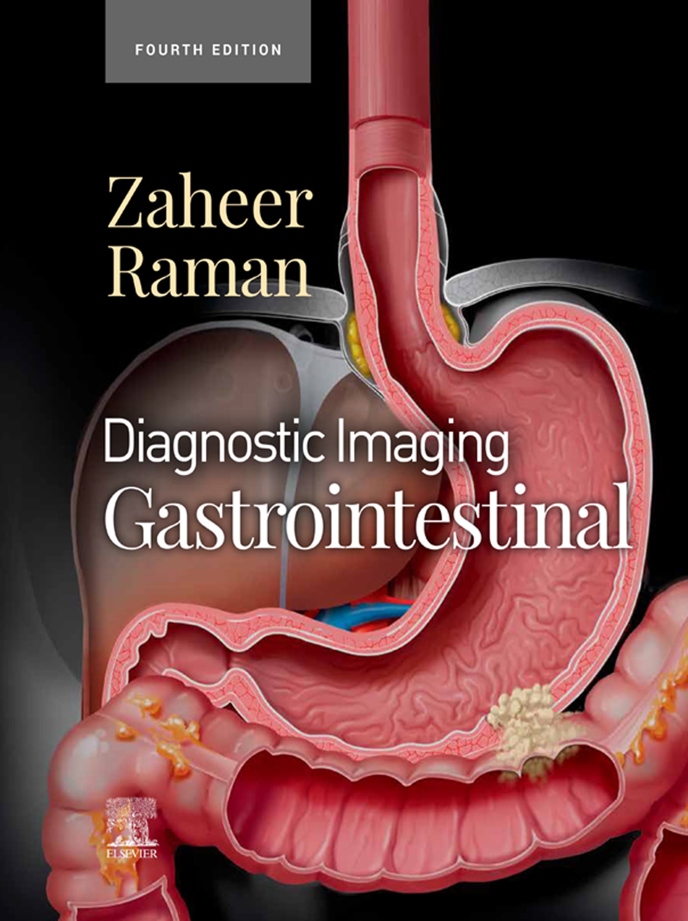 Diagnostic Imaging: Gastrointestinal, 4th Edition (EPUB)