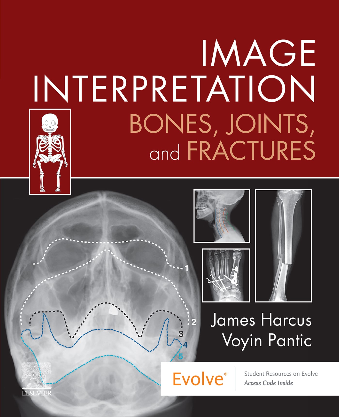 Image Interpretation: Bones, Joints, and Fractures (EPUB)