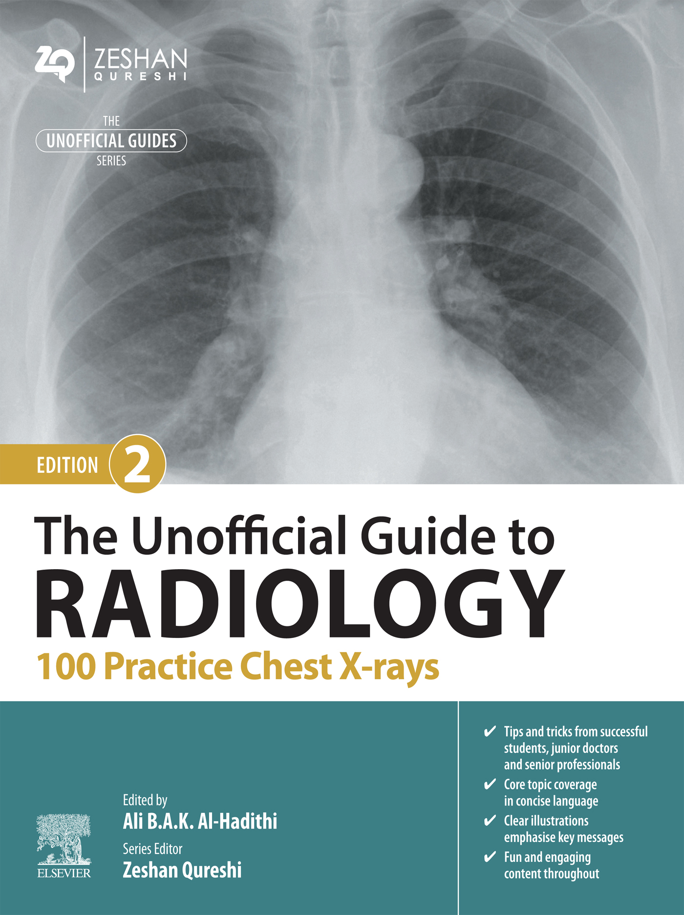 The Unofficial Guide to Radiology: 100 Practice Chest X-rays, 2nd Edition (EPUB)