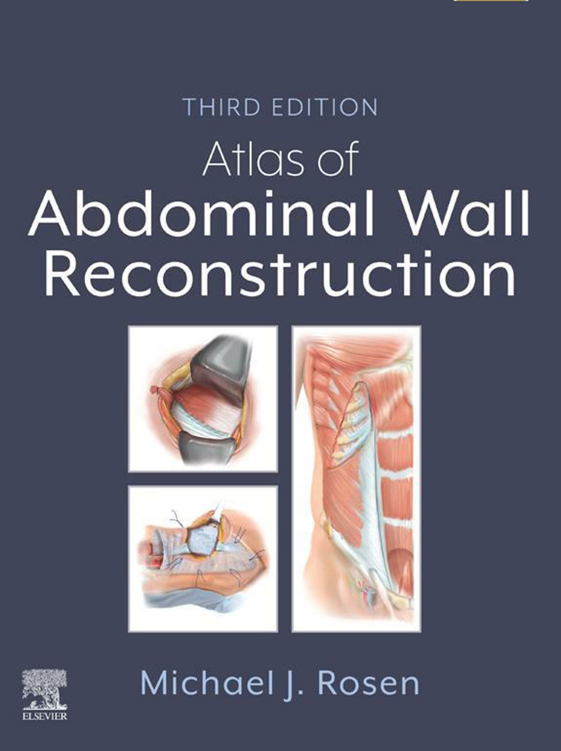 Atlas of Abdominal Wall Reconstruction, 3rd Edition (Original PDF from Publisher)