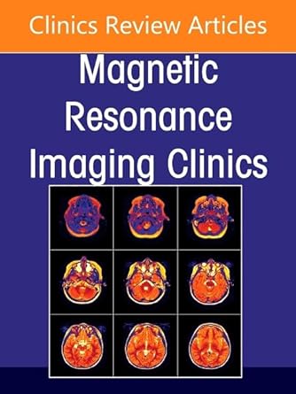 Plexus and Peripheral Nerve MR Imaging: Advances and Applications, An Issue of Magnetic Resonance Imaging Clinics of North America (Volume 33-3) (The Clinics: Radiology, Volume 33-3) (EPUB)