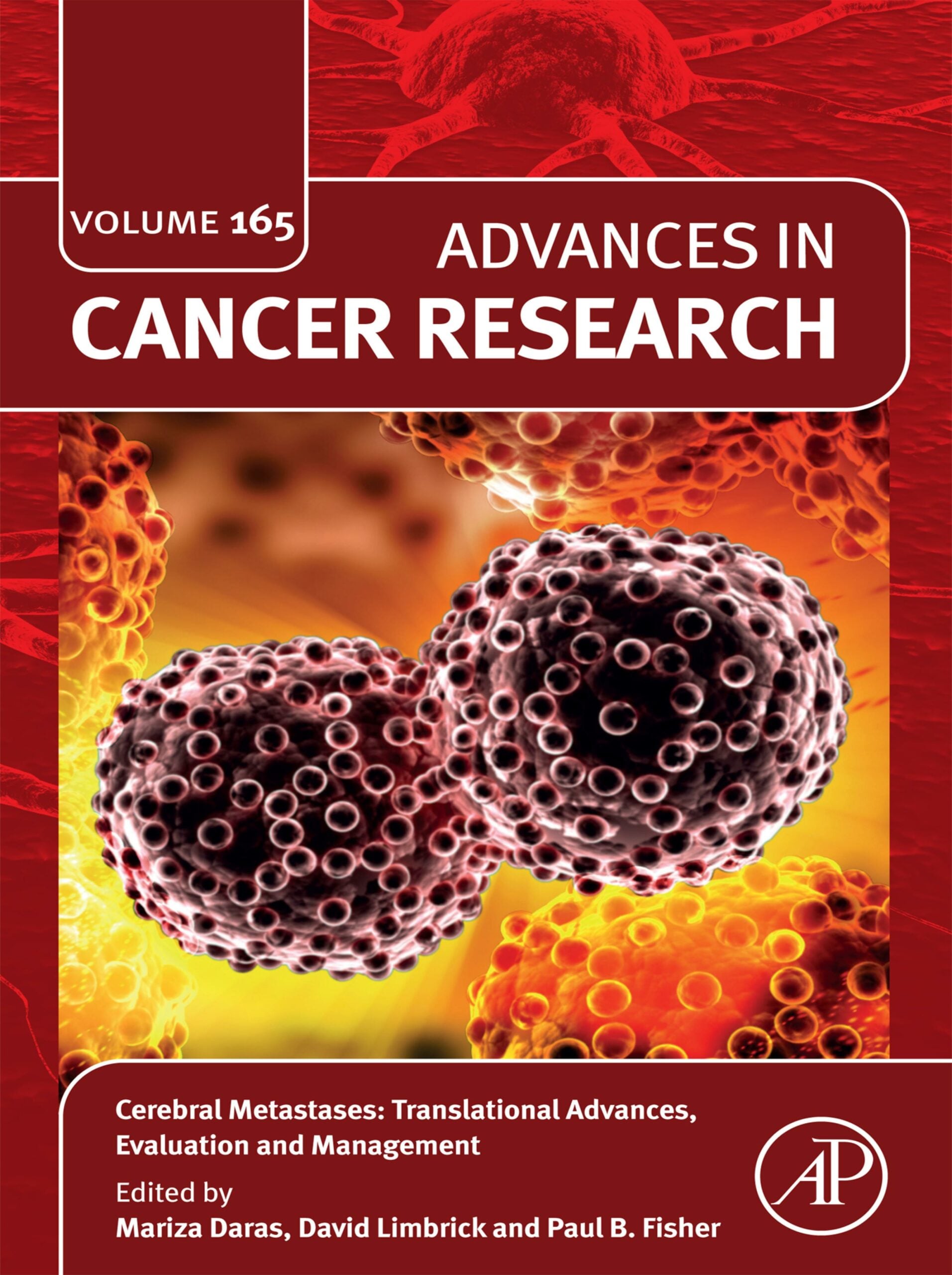 Cerebral Metastases: Translational Advances, Evaluation and Management (EPUB)