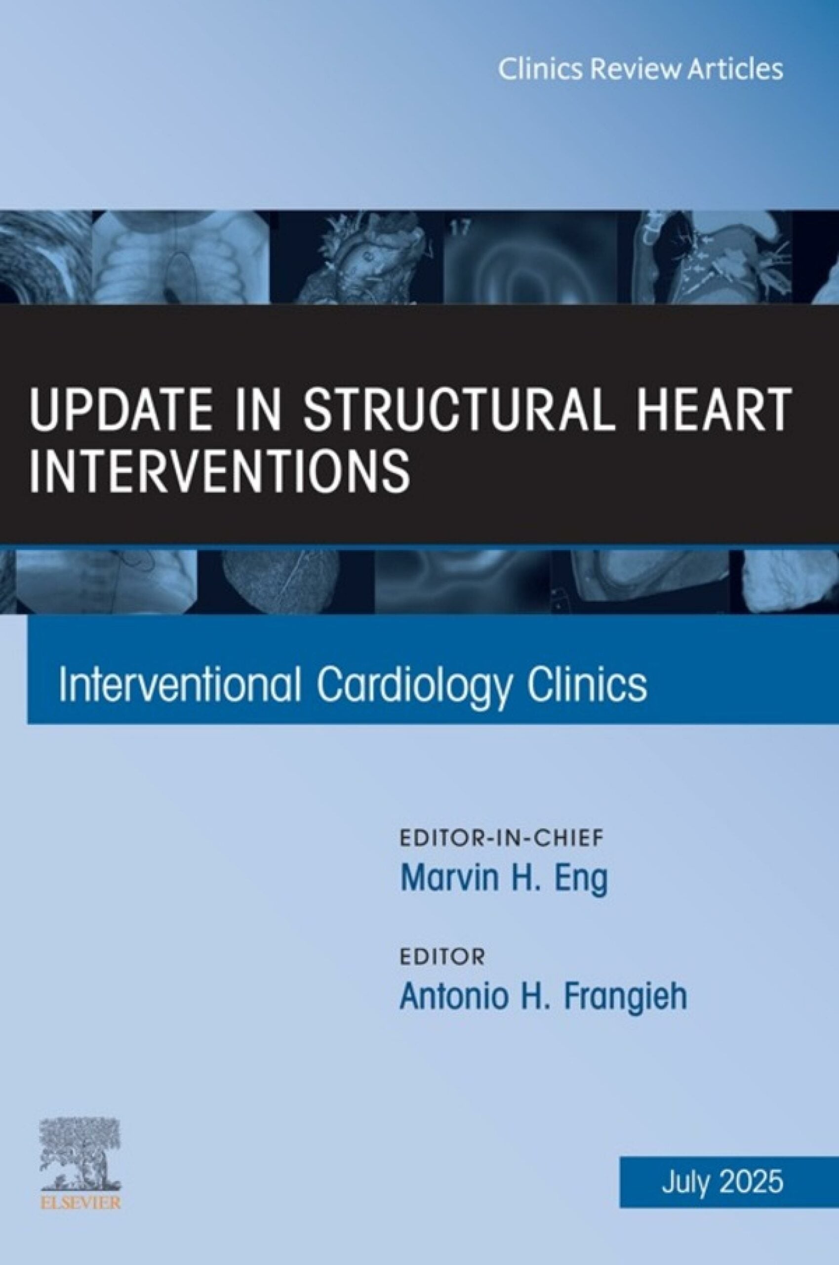 Update in Structural Heart Interventions, An Issue of Interventional Cardiology Clinics (EPUB)